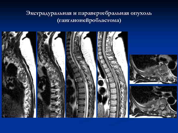 Планарное изображение лучевая диагностика