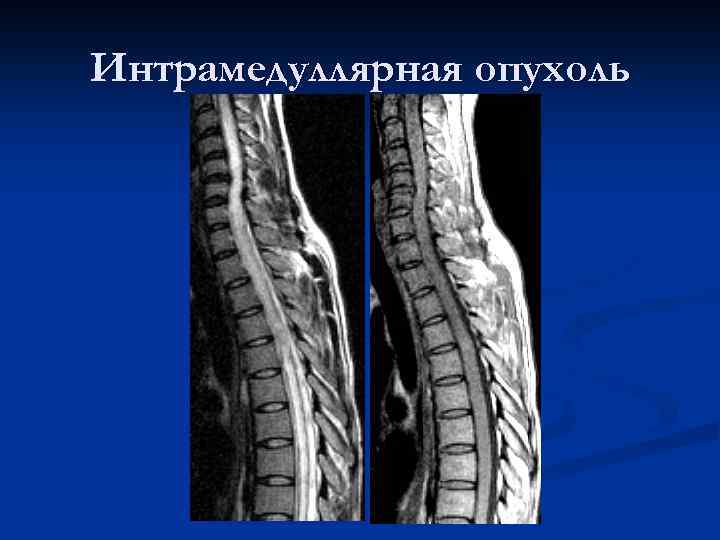 Планарное изображение лучевая диагностика