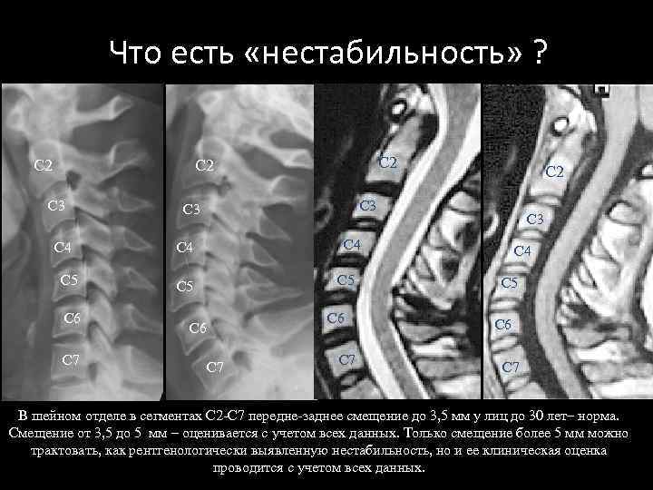 Что есть «нестабильность» ? C 2 C 2 C 3 C 4 C 5