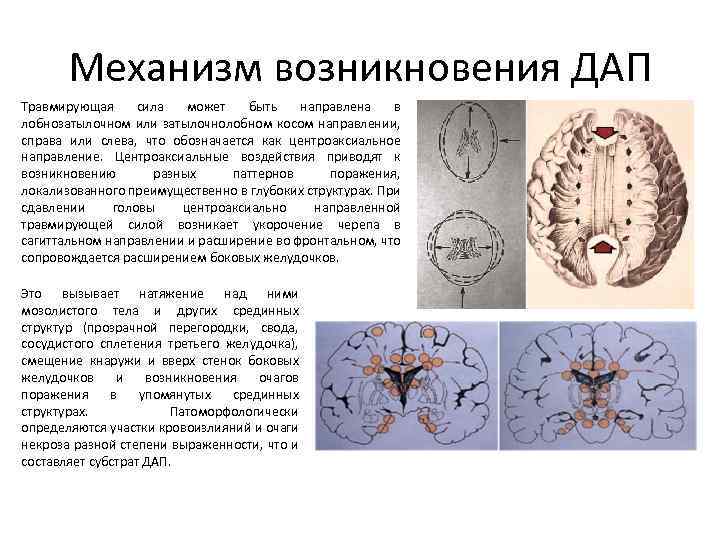 Механизм возникновения эмоций проект