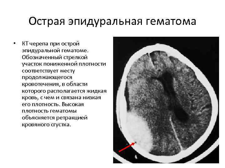 Параорбитальная гематома карта вызова скорой медицинской