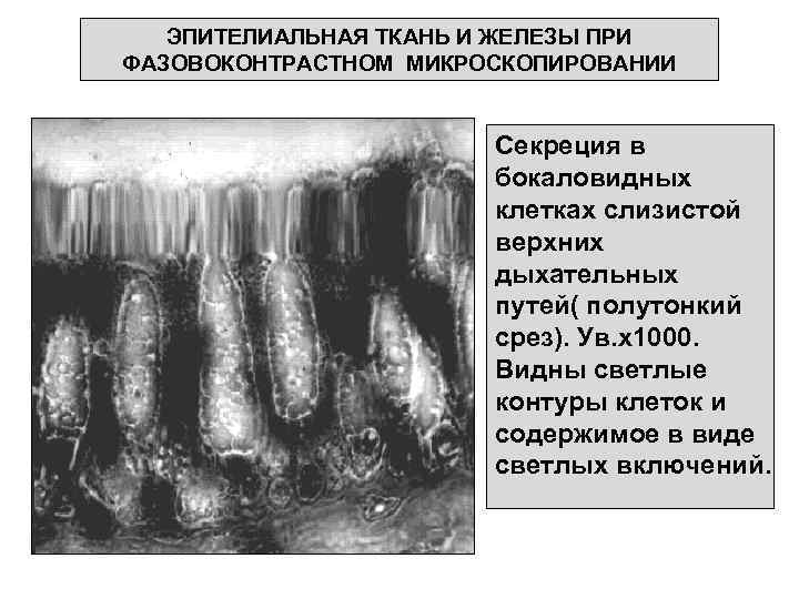 ЭПИТЕЛИАЛЬНАЯ ТКАНЬ И ЖЕЛЕЗЫ ПРИ ФАЗОВОКОНТРАСТНОМ МИКРОСКОПИРОВАНИИ Секреция в бокаловидных клетках слизистой верхних дыхательных