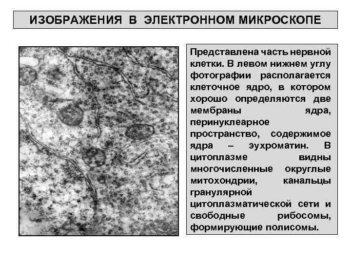 ИЗОБРАЖЕНИЯ В ЭЛЕКТРОННОМ МИКРОСКОПЕ Представлена часть нервной клетки. В левом нижнем углу фотографии располагается