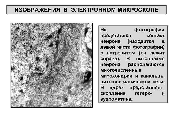 ИЗОБРАЖЕНИЯ В ЭЛЕКТРОННОМ МИКРОСКОПЕ На фотографии представлен контакт нейрона (находится в левой части фотографии)
