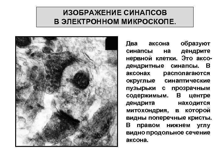 ИЗОБРАЖЕНИЕ СИНАПСОВ В ЭЛЕКТРОННОМ МИКРОСКОПЕ. Два аксона образуют синапсы на дендрите нервной клетки. Это