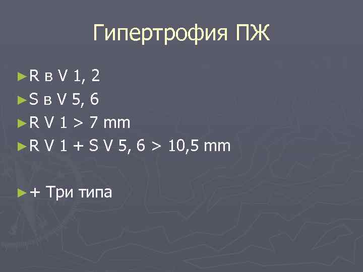 Гипертрофия ПЖ ►R в V 1, 2 ► S в V 5, 6 ►