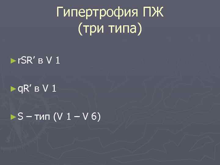 Гипертрофия ПЖ (три типа) ► r. SR’ ► q. R’ ►S в. V 1