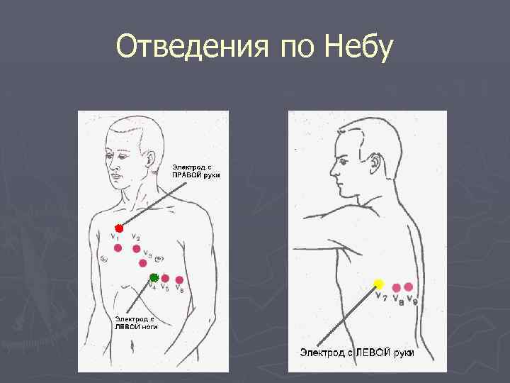 Отведения по Небу 