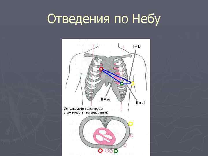 Отведения по Небу 