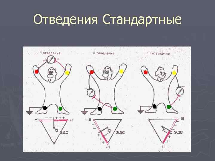 Отведения Стандартные 