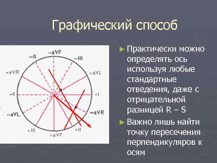 Графический способ ► Практически можно определять ось используя любые стандартные отведения, даже с отрицательной