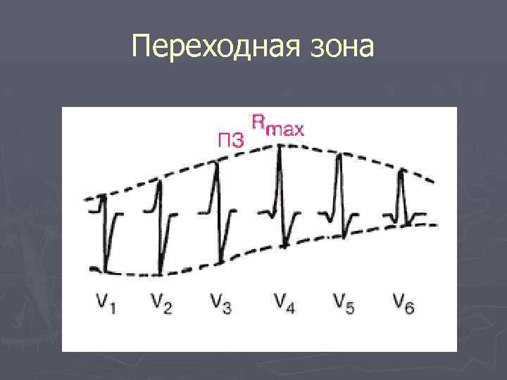 Переходная зона 
