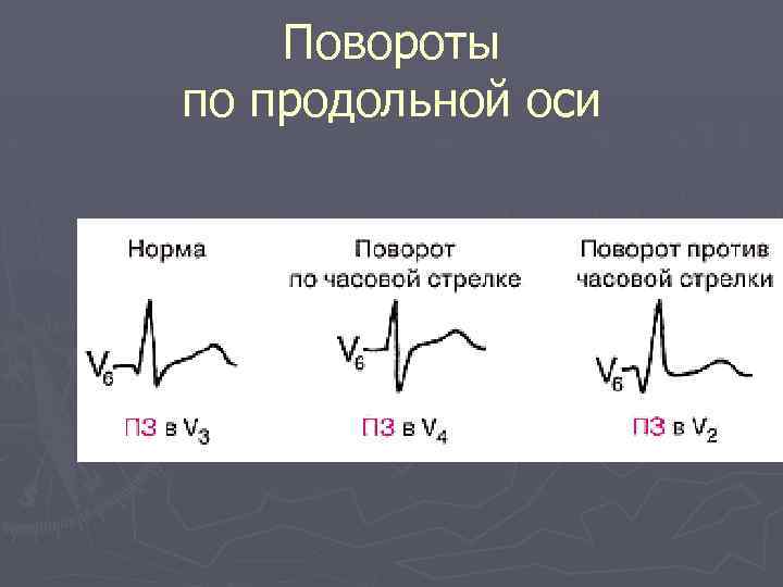 Повороты по продольной оси 