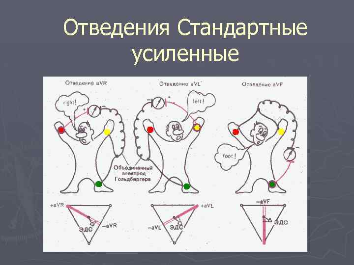 Отведения Стандартные усиленные 