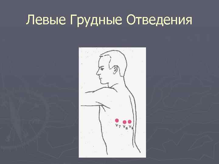Левые Грудные Отведения 