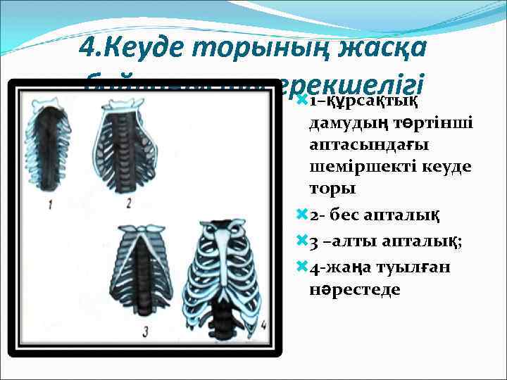 4. Кеуде торының жасқа байланысты ерекшелігі 1–құрсақтық дамудың төртінші аптасындағы шеміршекті кеуде торы 2