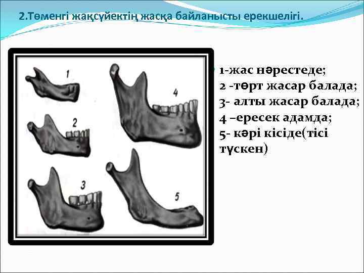 2. Төменгі жақсүйектің жасқа байланысты ерекшелігі. 1 -жас нәрестеде; 2 -төрт жасар балада; 3