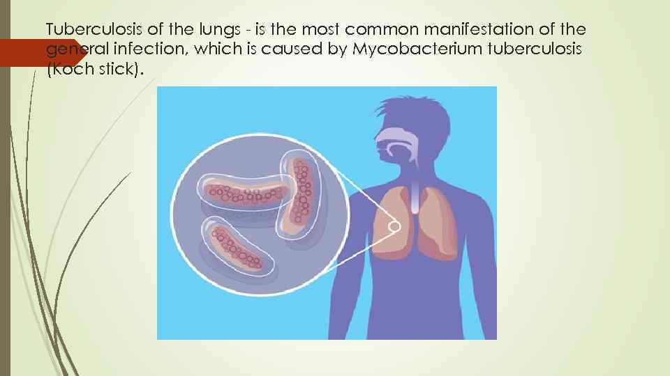 Tuberculosis of the lungs - is the most common manifestation of the general infection,