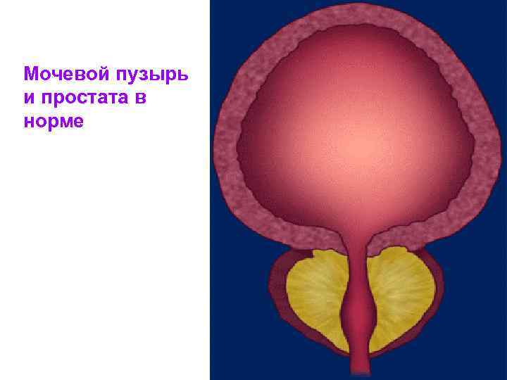 Мочевой пузырь и простата в норме 