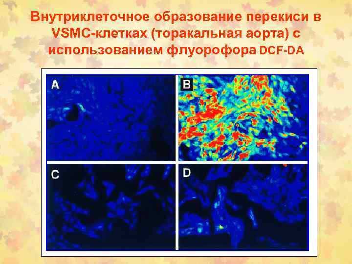 Внутриклеточное образование перекиси в VSMC-клетках (торакальная аорта) с использованием флуорофора DCF-DA 