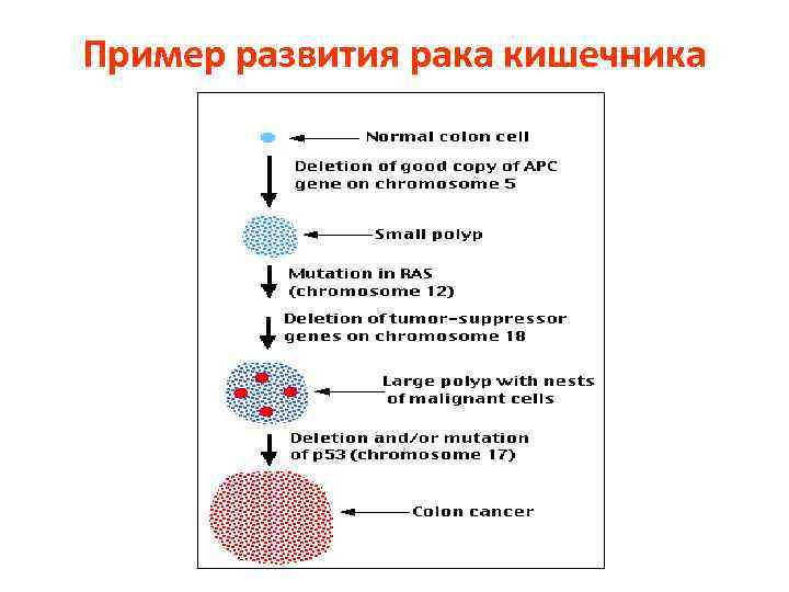 Пример развития рака кишечника 