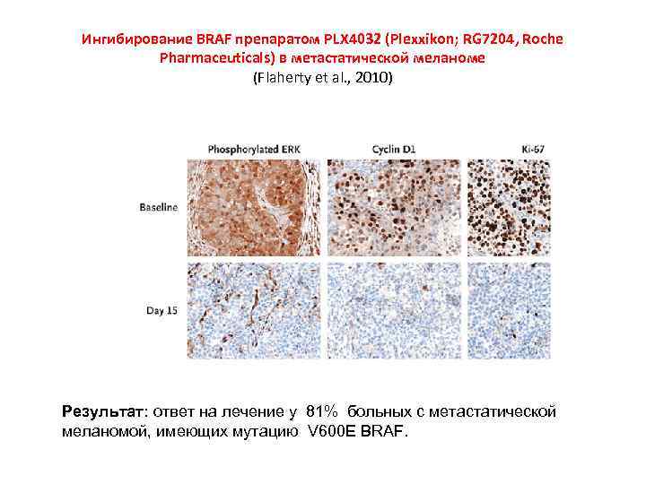 Ингибирование BRAF препаратом PLX 4032 (Plexxikon; RG 7204, Roche Pharmaceuticals) в метастатической меланоме (Flaherty