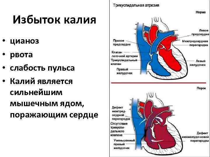 Избыток калия • • цианоз рвота слабость пульса Калий является сильнейшим мышечным ядом, поражающим