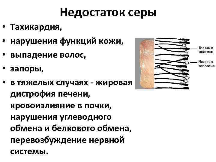 Недостаток серы • • • Тахикардия, нарушения функций кожи, выпадение волос, запоры, в тяжелых