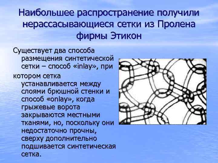 Наибольшее распространение получили нерассасывающиеся сетки из Пролена фирмы Этикон Существует два способа размещения синтетической