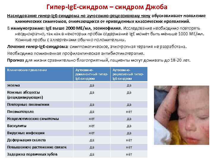 Гипер-Ig. E-синдром – синдром Джоба Наследование гипер-Ig. E-синдрома по аутосомно-рецессивному типу обусловливает появление клинических