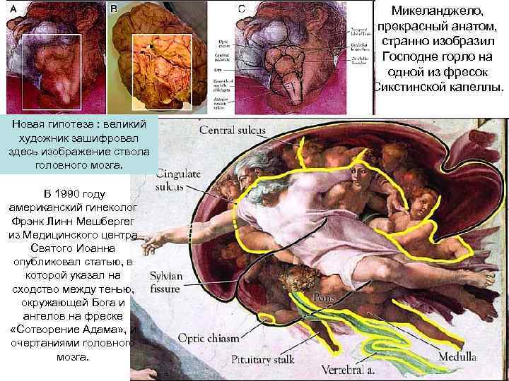 Микеланджело, прекрасный анатом, странно изобразил Господне горло на одной из фресок Сикстинской капеллы. Новая