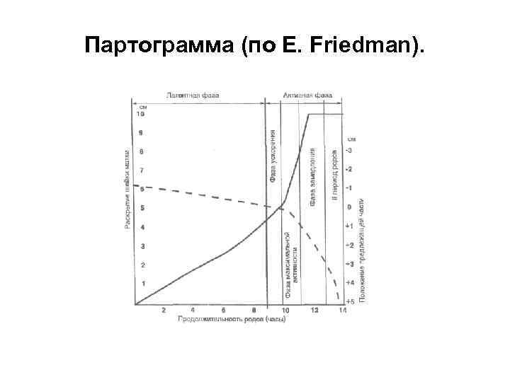 Партограмма (по E. Friedman). 