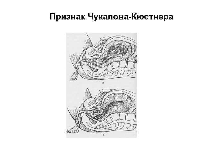 Признаки отделения плаценты