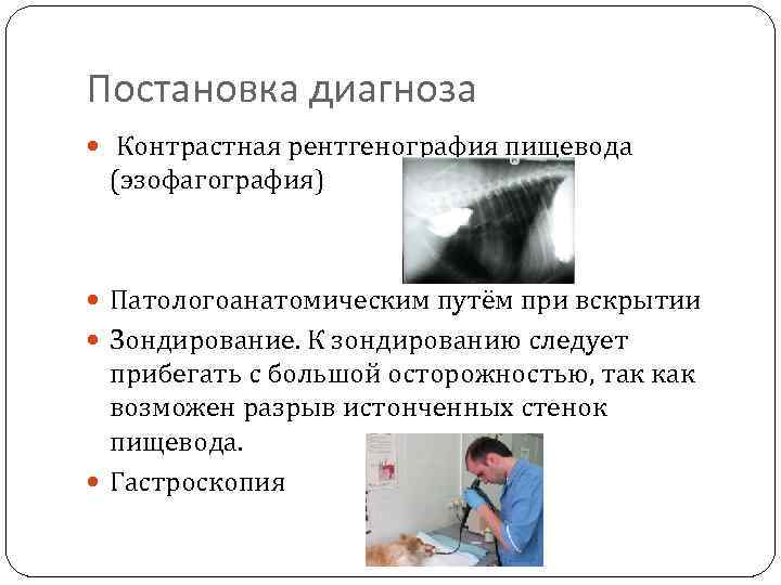 Постановка диагноза Контрастная рентгенография пищевода (эзофагография) Патологоанатомическим путём при вскрытии Зондирование. К зондированию следует