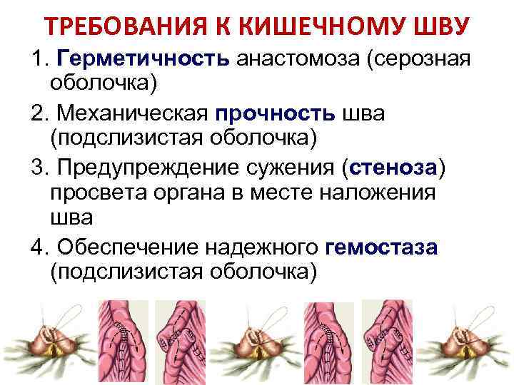 На какой из футляров стенки кишки наложение швов обеспечивает герметичность