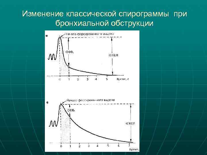 Изменение классической спирограммы при бронхиальной обструкции 