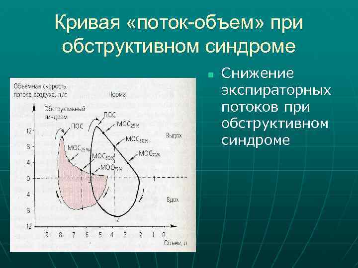 Кривая «поток-объем» при обструктивном синдроме n Снижение экспираторных потоков при обструктивном синдроме 