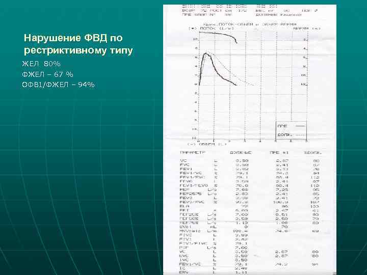 Нарушение ФВД по рестриктивному типу ЖЕЛ 80% ФЖЕЛ – 67 % ОФВ 1/ФЖЕЛ –