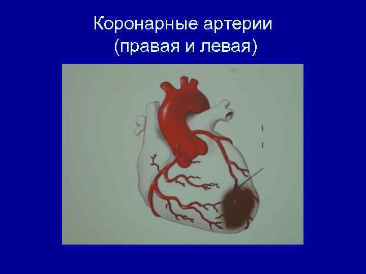 Коронарные артерии (правая и левая) 