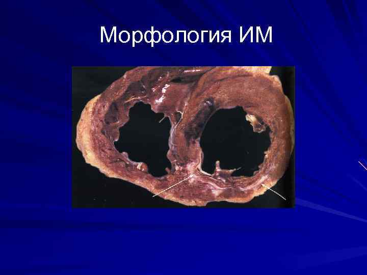 Морфология ИМ 