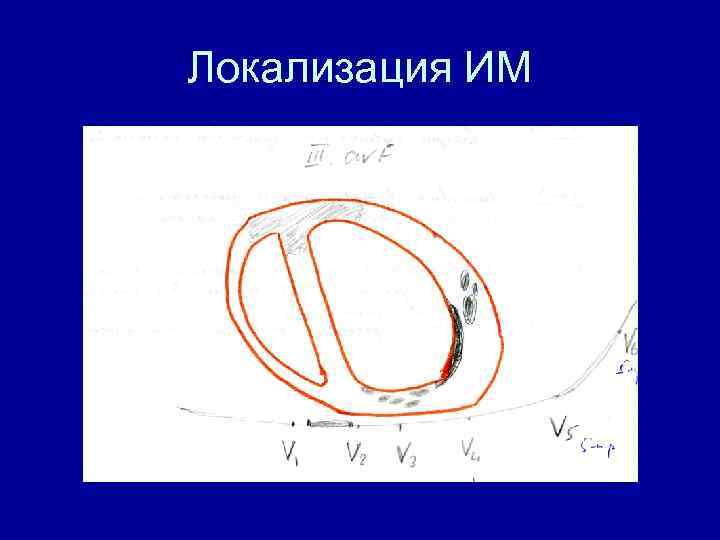 Локализация ИМ 