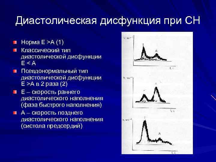 Диастолическая дисфункция при СН Норма Е >А (1) Классический тип диастолической дисфункции Е <