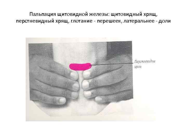 Пальпация щитовидной железы: щитовидный хрящ, перстневидный хрящ, глотание - перешеек, латеральнее - доли 
