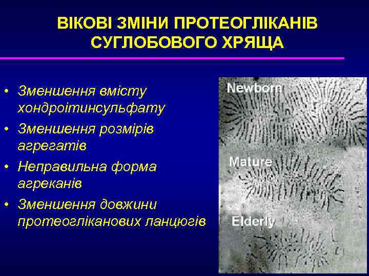 ВІКОВІ ЗМІНИ ПРОТЕОГЛІКАНІВ СУГЛОБОВОГО ХРЯЩА • Зменшення вмісту хондроітинсульфату • Зменшення розмірів агрегатів •