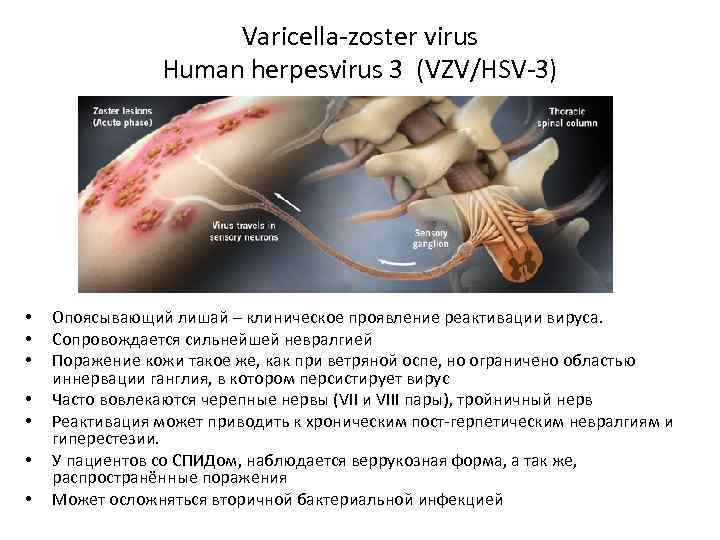 Varicella-zoster virus Human herpesvirus 3 (VZV/HSV-3) • • Опоясывающий лишай – клиническое проявление реактивации