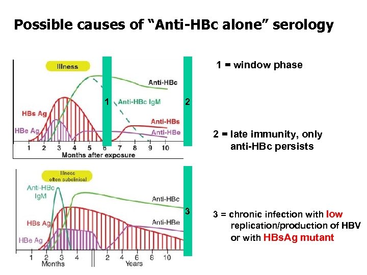 Possible causes of “Anti-HBc alone” serology 1 = window phase 1 2 2 =