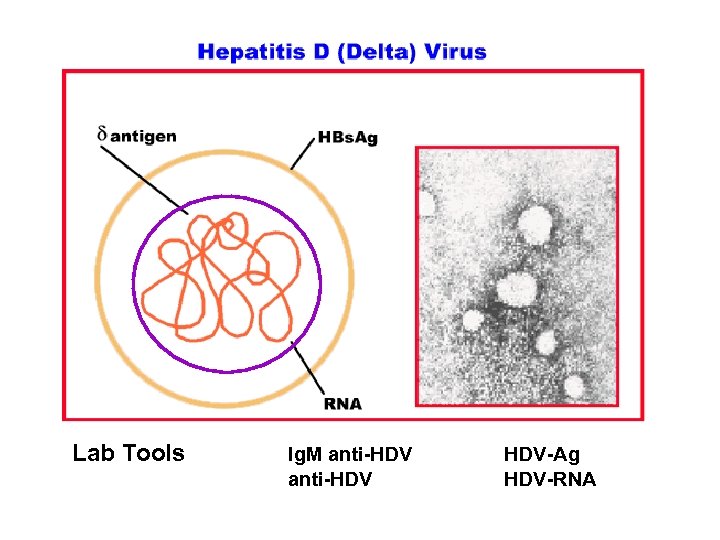 Lab Tools Ig. M anti-HDV HDV-Ag HDV-RNA 