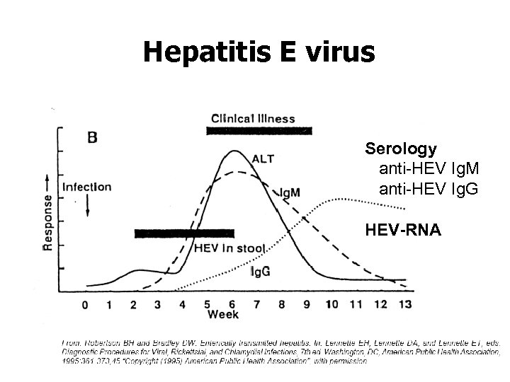 Hepatitis E virus Serology anti-HEV Ig. M anti-HEV Ig. G HEV-RNA 