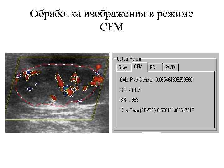 Обработка изображения в режиме CFM 