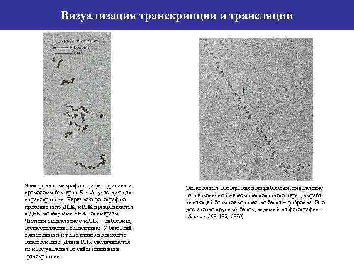Визуализация транскрипции и трансляции Электронная микрофотография фрагмента хромосомы бактерии E. coli, участвующая в транскрипции.